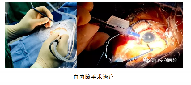 相約星期六，省級眼科、心內(nèi)科專家到院坐診、開展手術(shù)治療