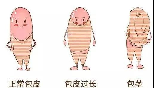 【保山安利醫(yī)院】家長速看！暑期包皮手術(shù)預(yù)約正當(dāng)時！