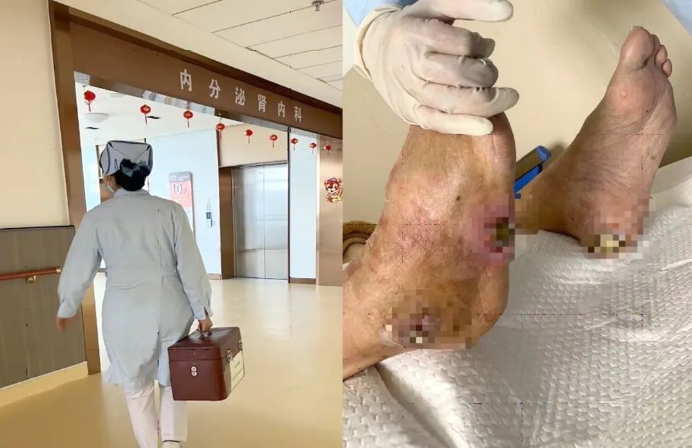 【保山安利醫(yī)院】傷口治療一站式，健康生活零距離！